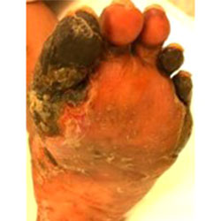 woundcare