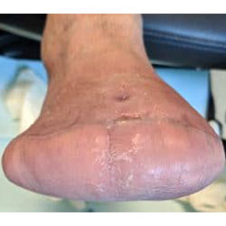 woundcare