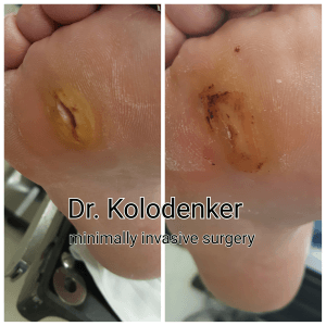 woundcare