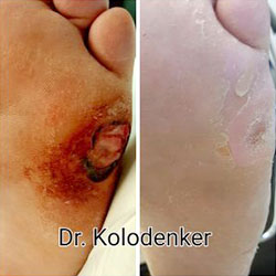 woundcare