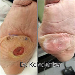 woundcare